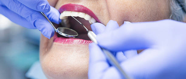 Best Urgent Care for Lost Fillings or Crowns in Pinckney, MI